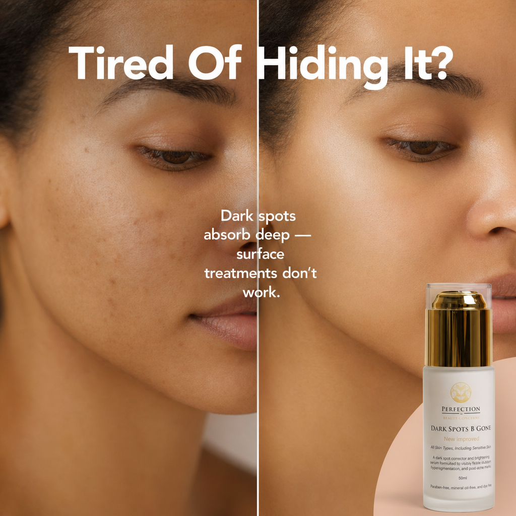 Dark Spots B Gone