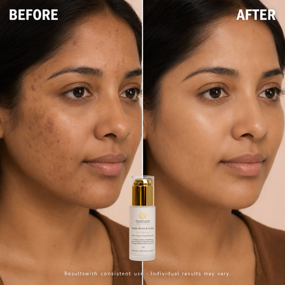 Dark Spots B Gone